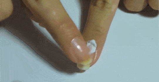 [孩子]是缺乏维生素？3个原因，大多数家长都不知道宝宝手上总长倒刺