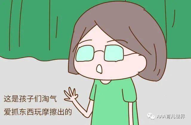 [孩子]是缺乏维生素？3个原因，大多数家长都不知道宝宝手上总长倒刺