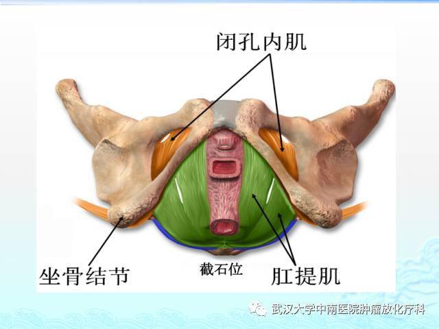 女性盆腔解剖与断层影像