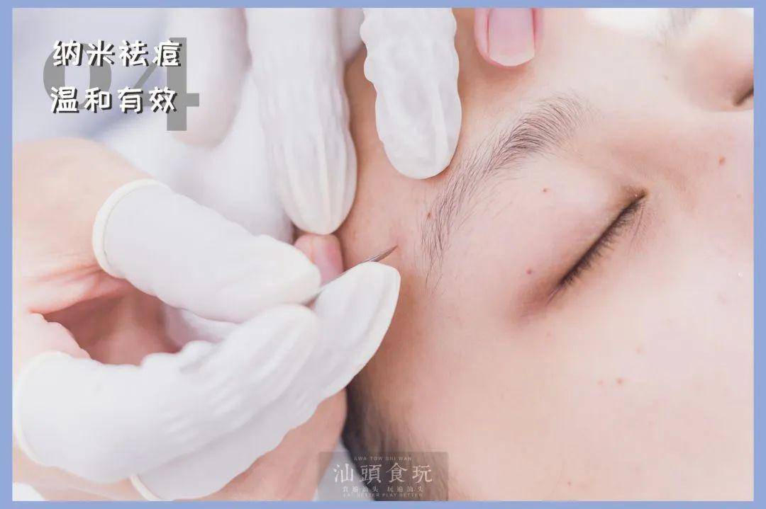 怎么护理皮肤显得很干净 66744c3bb0e7432484674691e0c2806a.jpeg