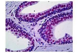 胰岛素是哪年合成的 fa039523fe684156b498570ac324a9fd.jpeg