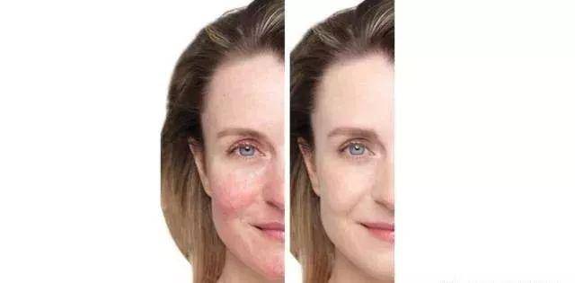 皮肤保养和不保养 663de79d19e74c3eb2d0f3d6f01738fb.jpeg