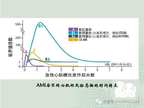 心肌三项的临床意义和时效性