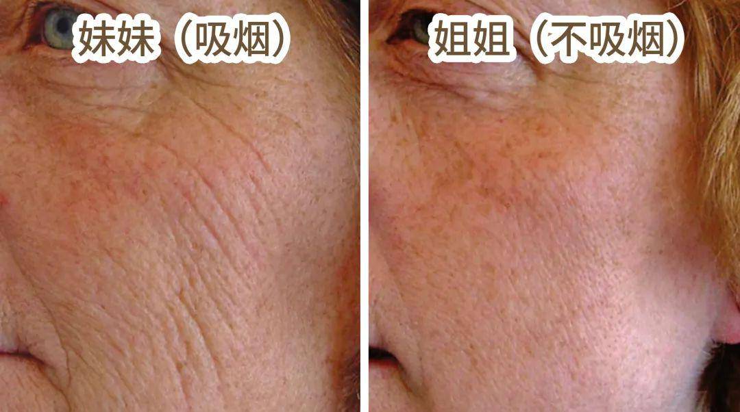 同龄人注定比同龄人老得快二手烟中的你