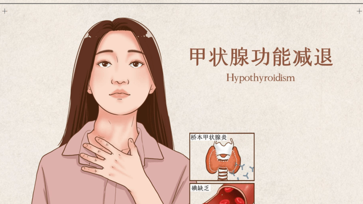 甲减患者常见的7大症状,可以自测吗?