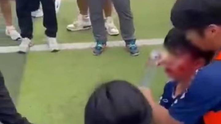 四川贡嘎杯高校足球赛上有球员被打,你支持依纪依规严肃处理吗?