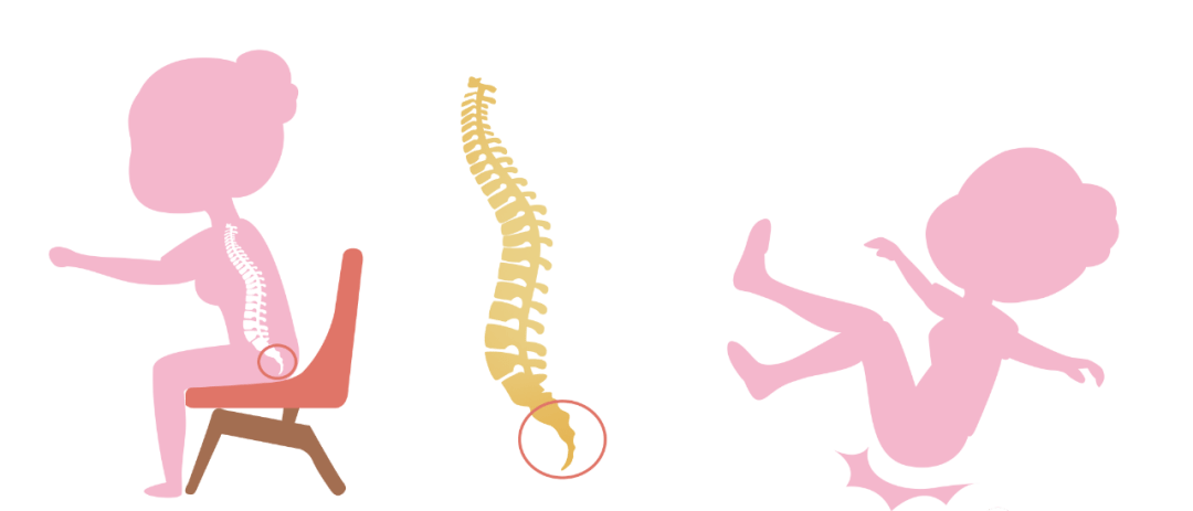 关于产后尾骨痛的10条专家建议