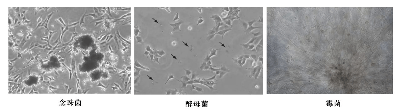 在显微镜下比较容易判断污染类型,念珠菌呈卵圆状,在细胞周边生长