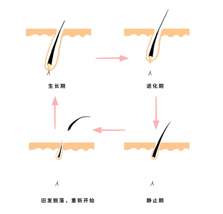 雄激素性脱发(脂溢性脱发)防脱生发避雷指南!