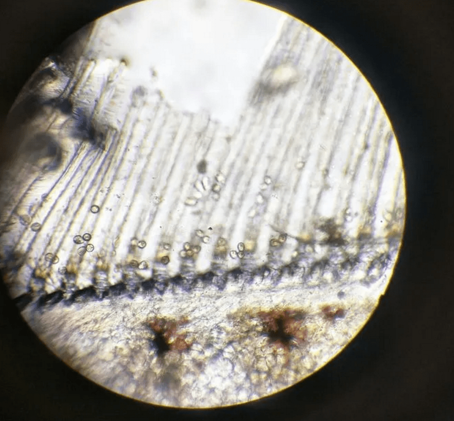 还在为对虾纤毛虫问题困扰?解决纤毛虫有新的防控方法