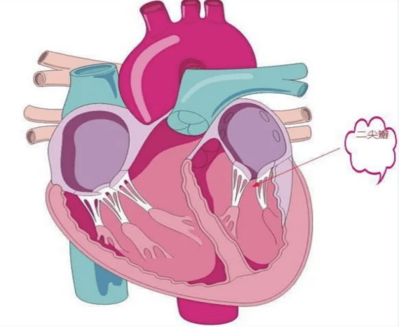 捍宇医疗知识科普:心脏的"心门"被撬开,关于二尖瓣不全的一些事儿