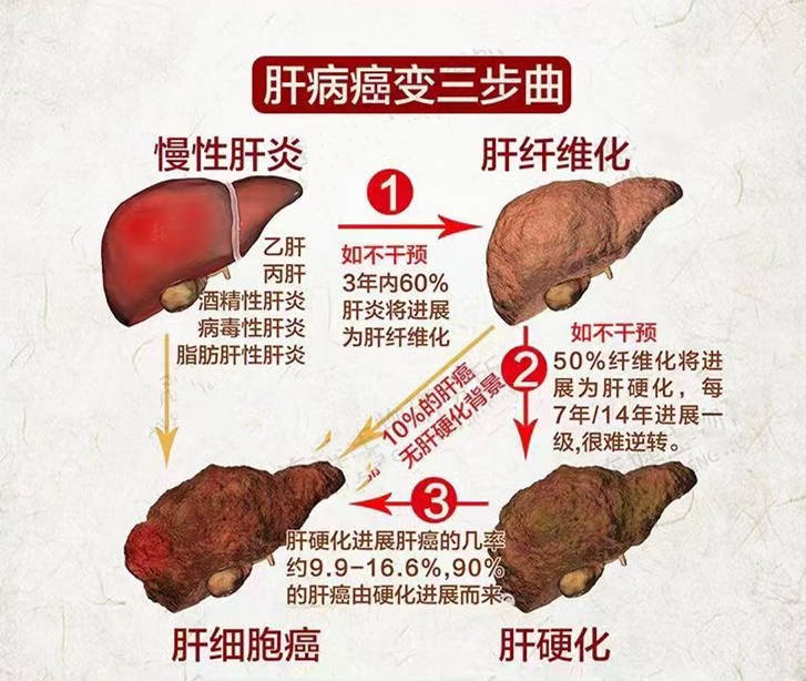 被称为"肝毒克星"的万秘堂熊胆粉,是怎么一步步清除肝毒的?_肝脏