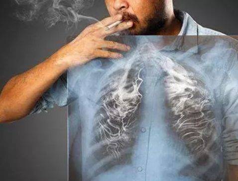 常吸烟的人,如果肺部出现严重损伤,会有哪些表现?