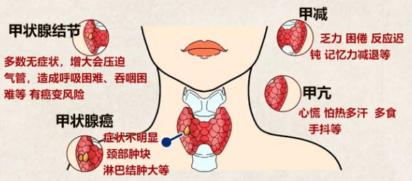 北京中西医结合甲状腺专家合作诊疗中心，医疗引领，科教同行