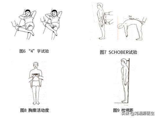 16.强直性脊柱炎实验室检查项目有哪些?