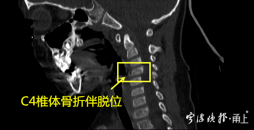 下肢|小区这个地方千万注意！@西宁家长！3岁男孩险些下肢瘫痪