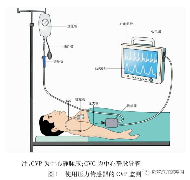 中心静脉压单位 来自搜狐网