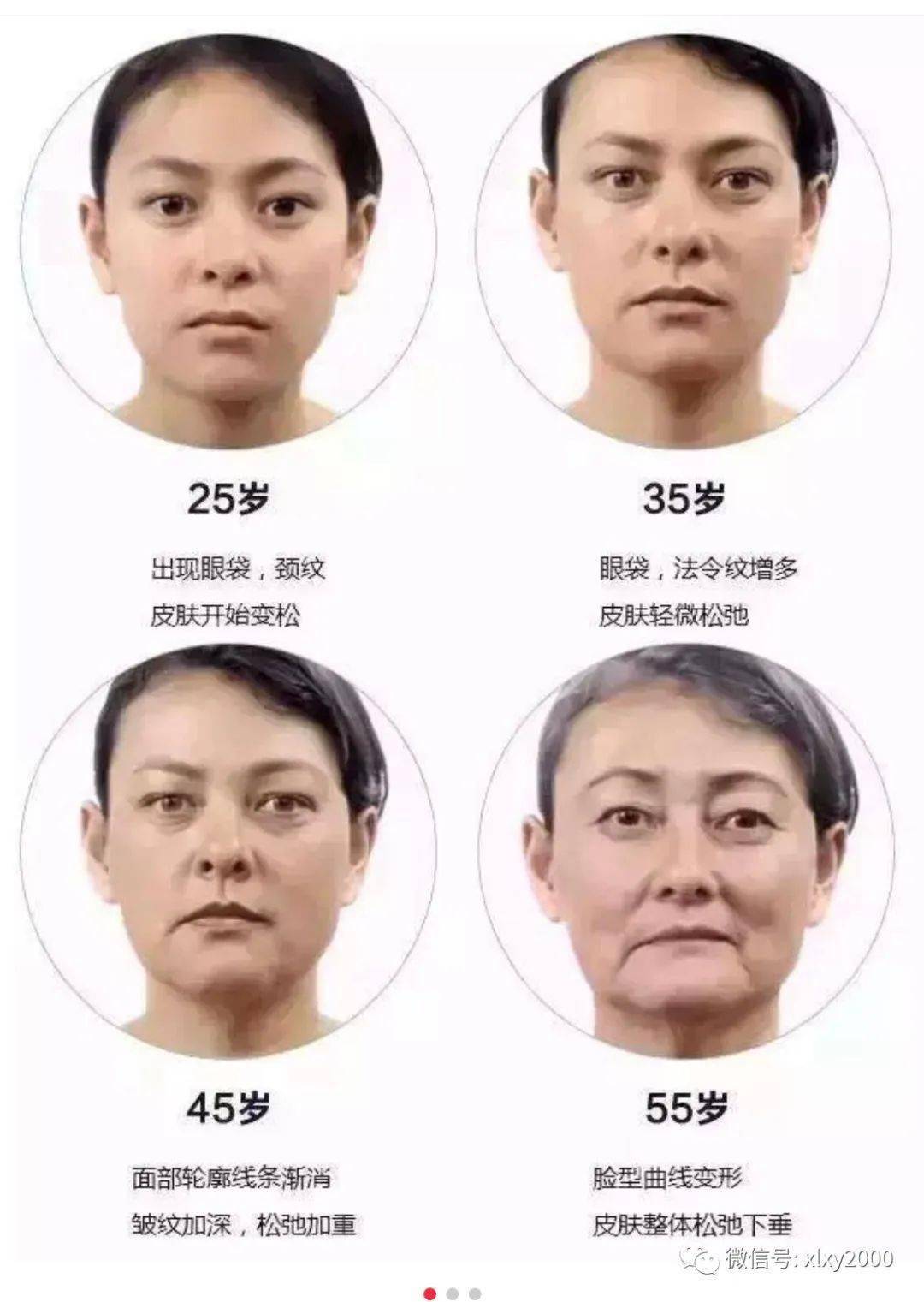 筋膜层肌肉层骨膜层皮肤衰老的标志,抬头纹,川字纹,眼角皱纹,眼周幼纹