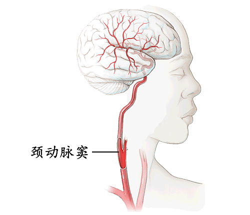 不过一定别碰这个死穴——颈动脉窦. 颈动脉窦 .