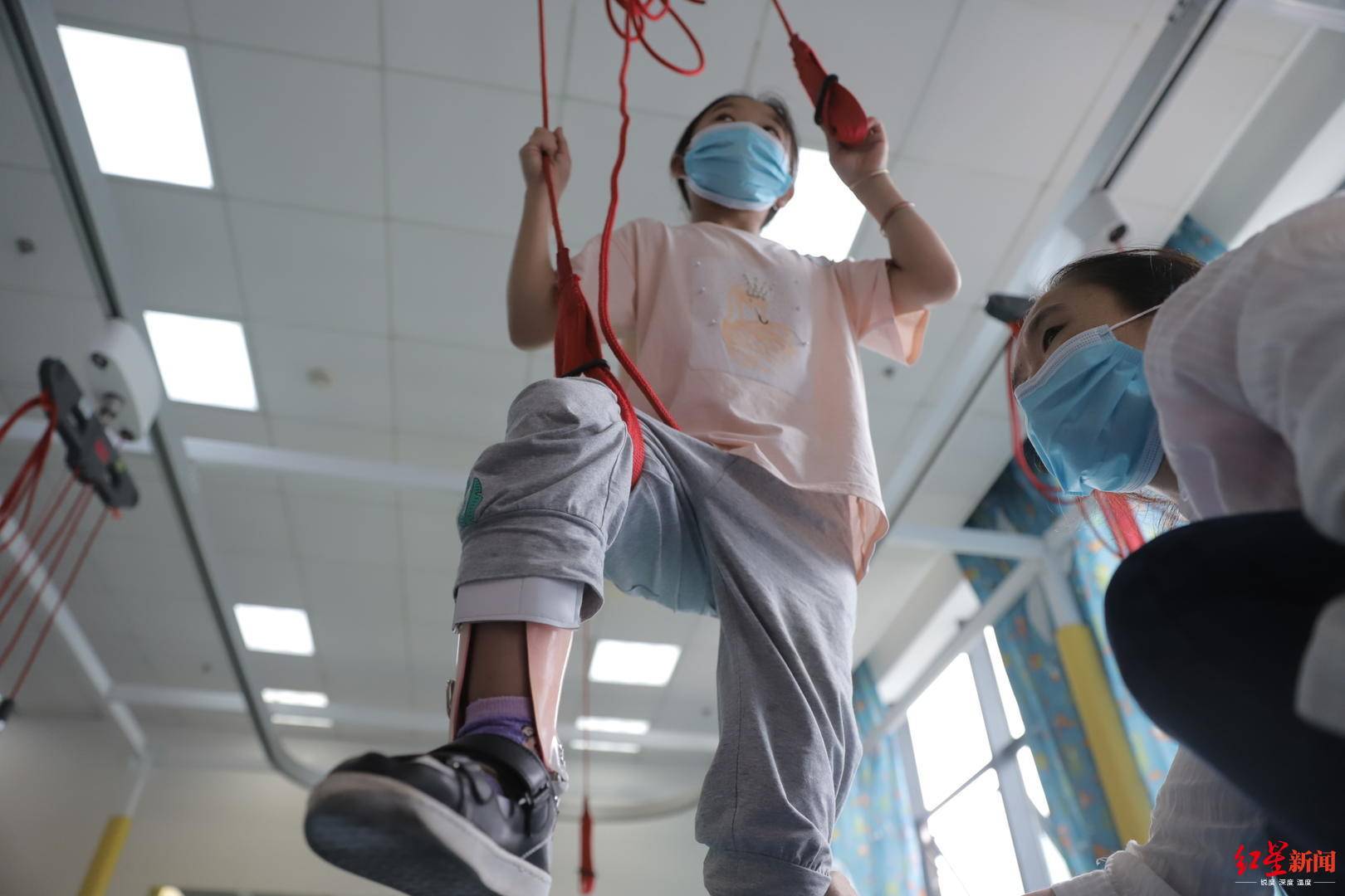脑瘫|妹妹是她的“拐杖”!现在,患脑瘫的她终于可以独立行走了曾经