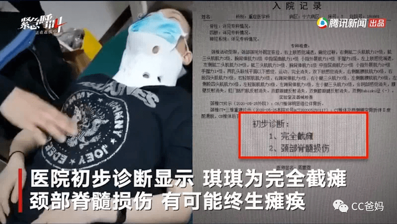 琪琪|从来没有人告诉你，这游戏有多危险！女研究生玩蹦床摔成瘫痪