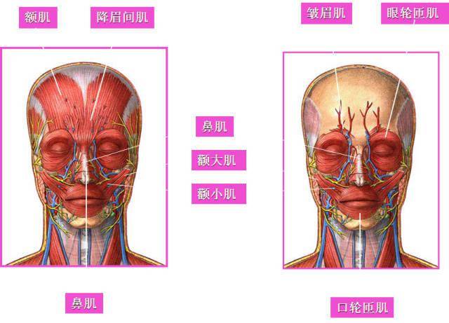 眉间纹(川字纹):位于两眉之间,多为2～3条,主要为垂直走向,为皱眉肌