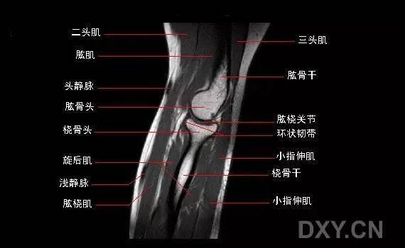 影像解剖 | 肘关节mri图谱超全整理