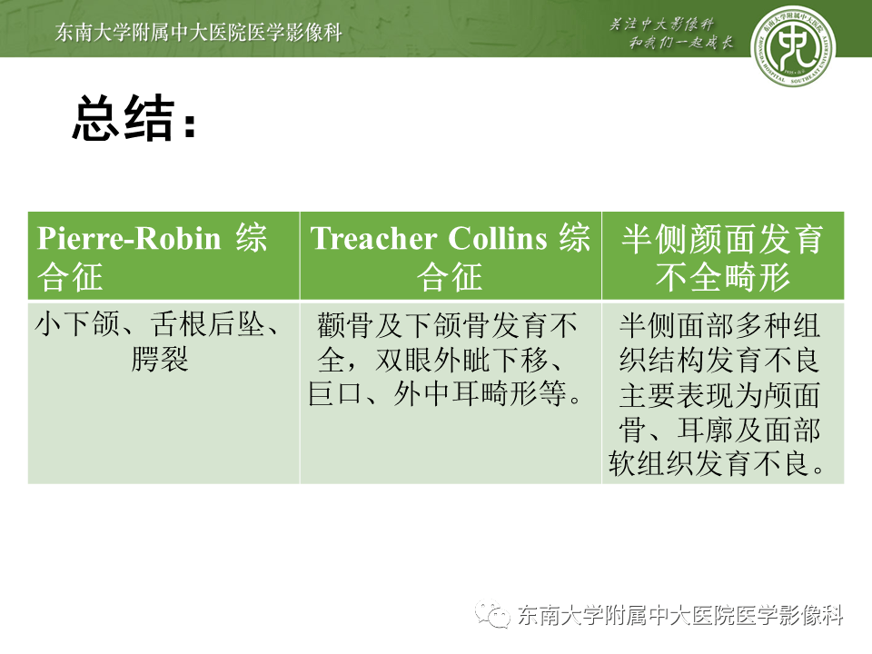 15 肌骨系统疾病—pierre-robin 综合征