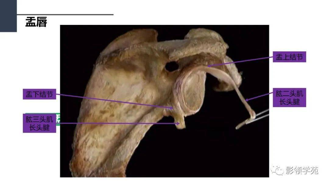 肩关节解剖及常见疾病影像表现
