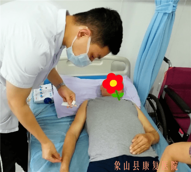 【针灸疗法】中风失语后的舌针治疗