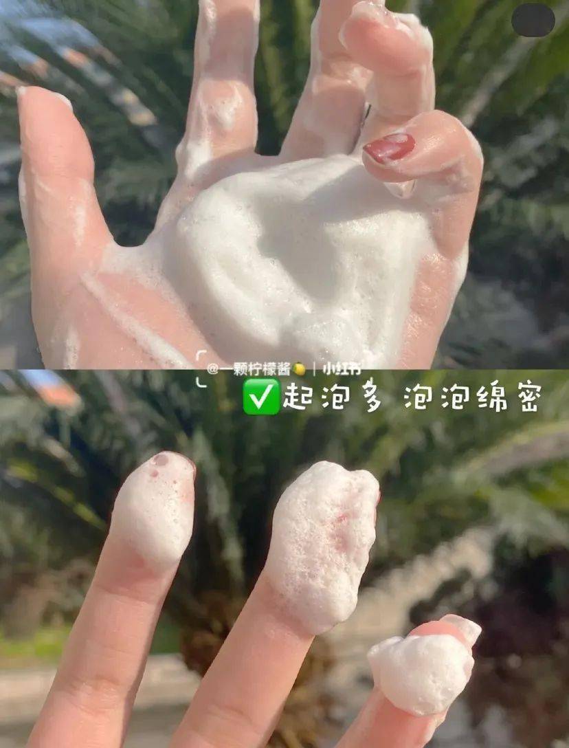 李佳琦推荐的脱发克星!一次就能拯救头屑头痒头油,用了它头发都会跳舞!