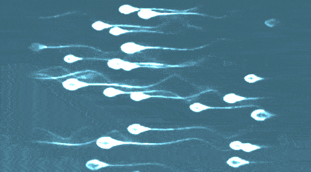 精液常规检查指标,怎样的精液才正常?