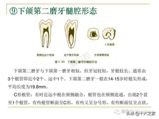 牙体髓腔解剖系统开髓开髓洞型及根管常用器械的认识和使用