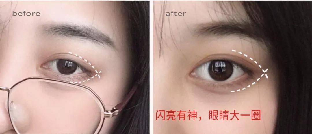 一片=10贴眼膜！解救“疲劳眼”！25分钟蒸走干黑眼圈，还你少女明眸