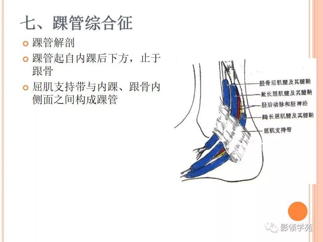 病因:距骨三角骨急性骨折或慢性应力性骨折,胫骨后部或附近肌腱韧带