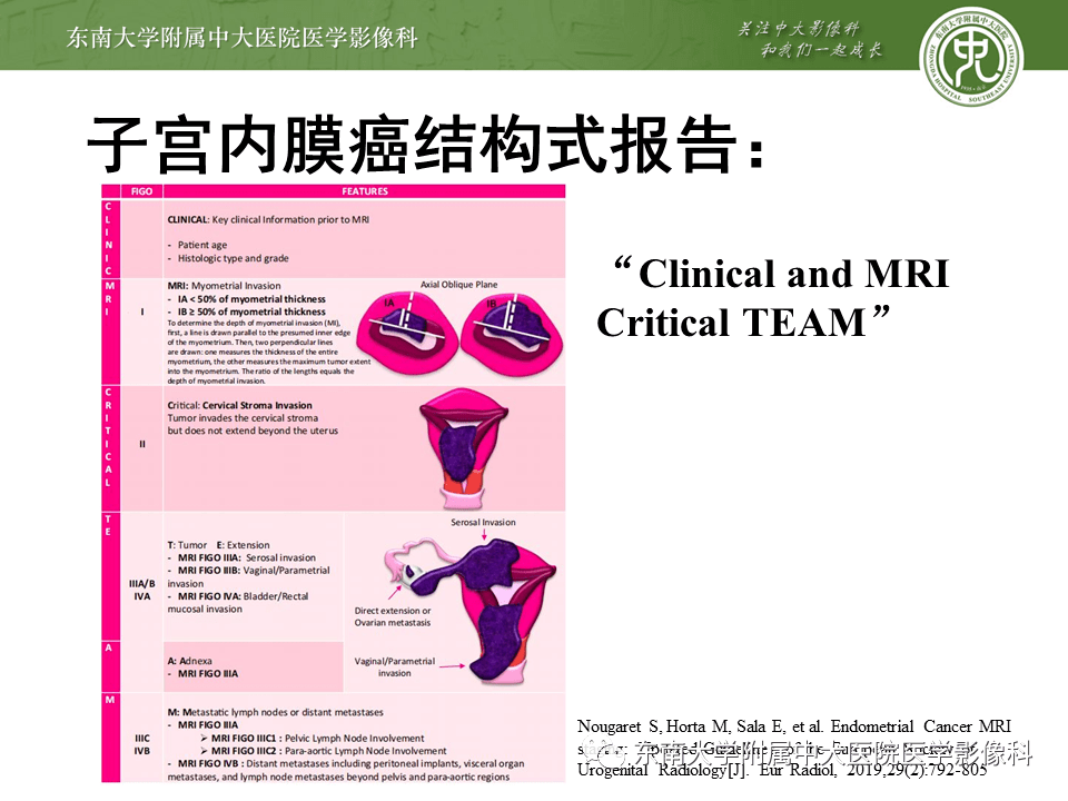 子宫内膜癌mri分期及结构式报告