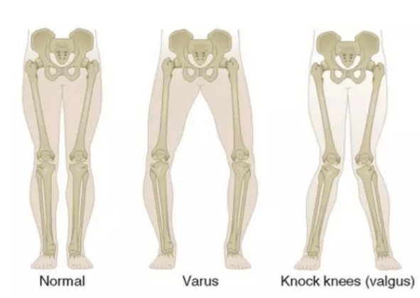 宝宝|为什么在欧美一律禁止？这个母婴界炙手可热的“育儿神器”