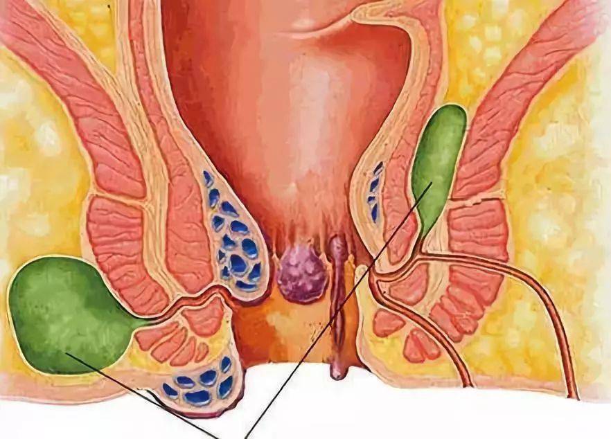 2 3 肠炎 大便带粘液,可能与人体肠道炎症有关,如饮食不洁,致使细菌