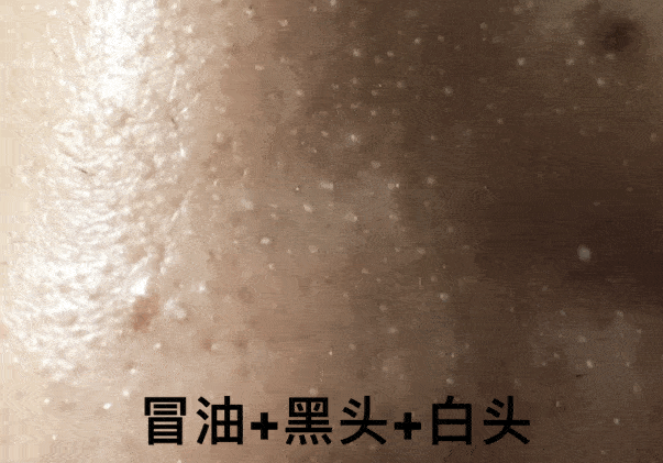 毛孔|原来想要拥有干净、清透的“初恋素颜脸”，只需要做好这一步！