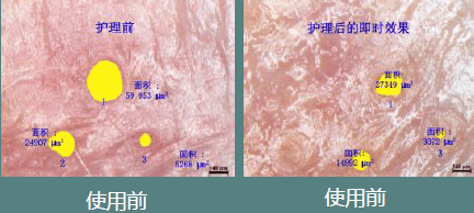 毛孔|原来想要拥有干净、清透的“初恋素颜脸”，只需要做好这一步！