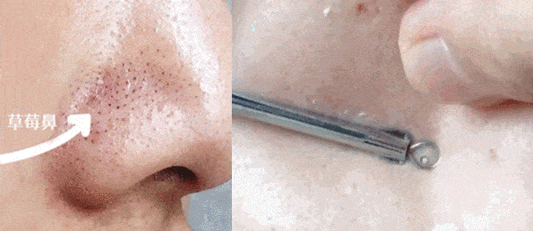 毛孔|原来想要拥有干净、清透的“初恋素颜脸”，只需要做好这一步！