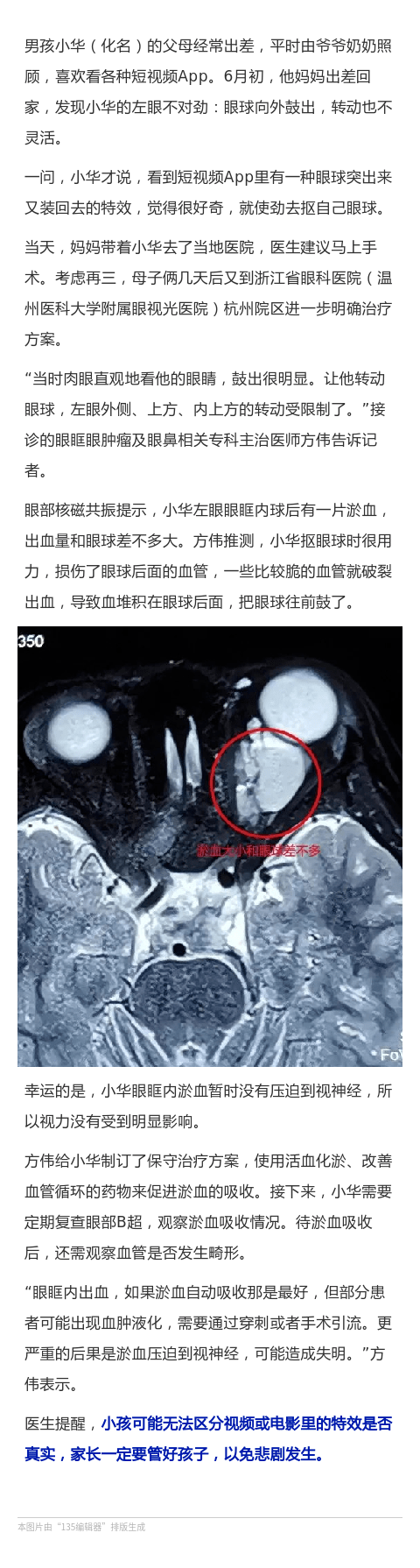 太可怕!模仿视频特效,浙江6岁男孩把自己眼球抠坏了