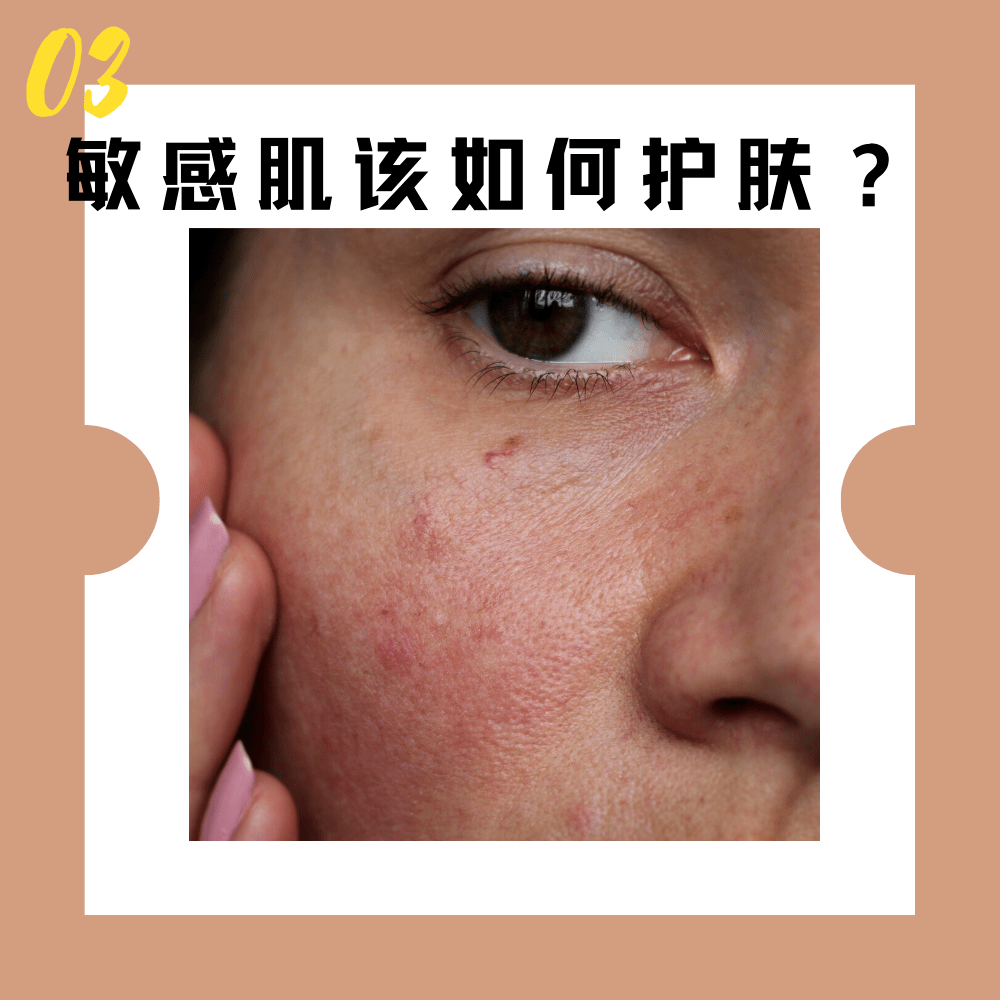 肌肤|傻子才听吴昕的敷三明治面膜！