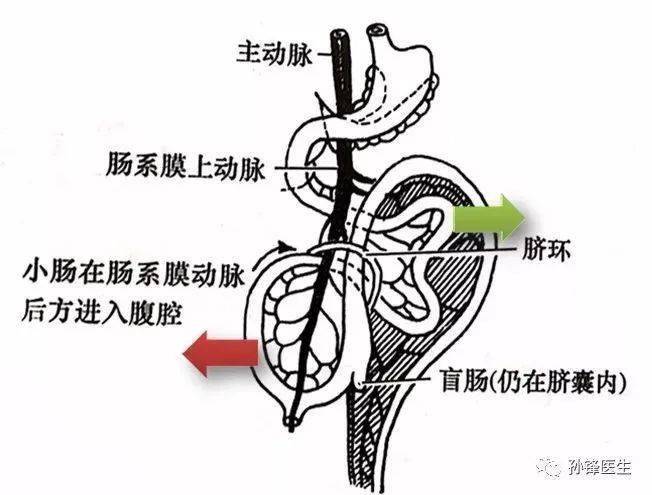 袢通过增长,生理性旋转退回腹腔,初步建立了正常的解剖方位和毗邻关系