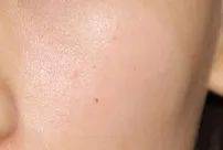 肌肤|傻子才听吴昕的敷三明治面膜！