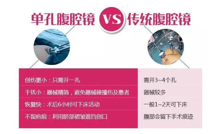 手术不留疤,什邡市人民医院专家为您解答单孔腹腔镜手术