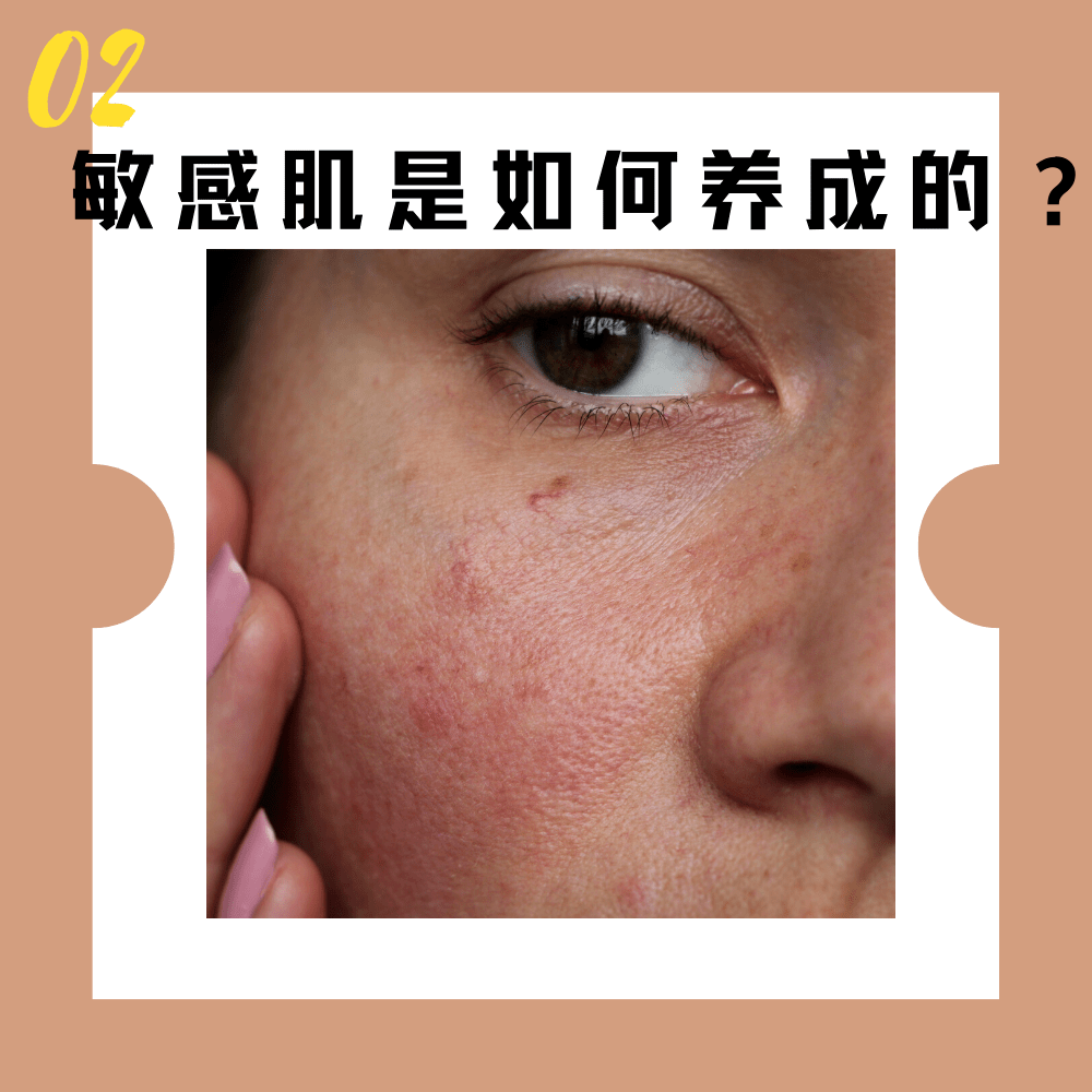 肌肤|傻子才听吴昕的敷三明治面膜！