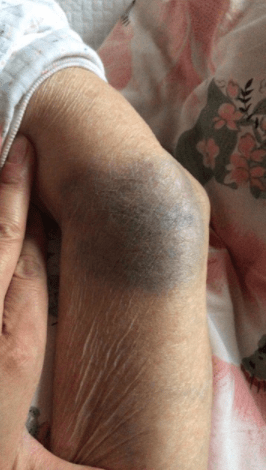 虐待|太可恨！16秒掌掴脚踢老人6次！一保姆被检方批捕