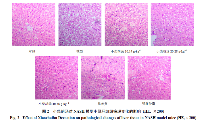 小柴胡汤对非酒精性脂肪性肝炎模型小鼠的保护作用研究