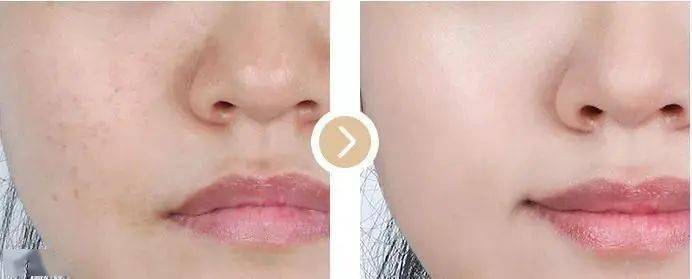 陈数|43岁的陈数演“女配”竟艳压女主佟丽娅,看了她的状态,我果断种草了这个东西......